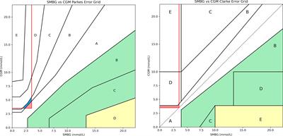 The hypoglycaemia error grid: A UK-wide consensus on CGM accuracy assessment in hyperinsulinism